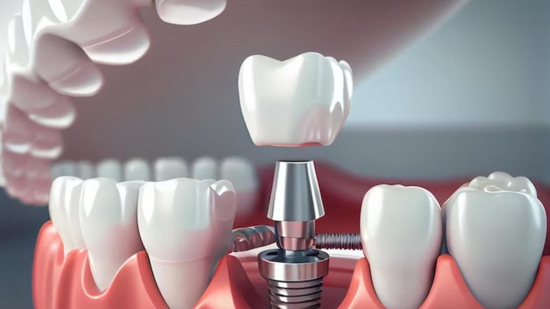 Aging Gracefully: How Dental Health Can Impact Your Golden Years
